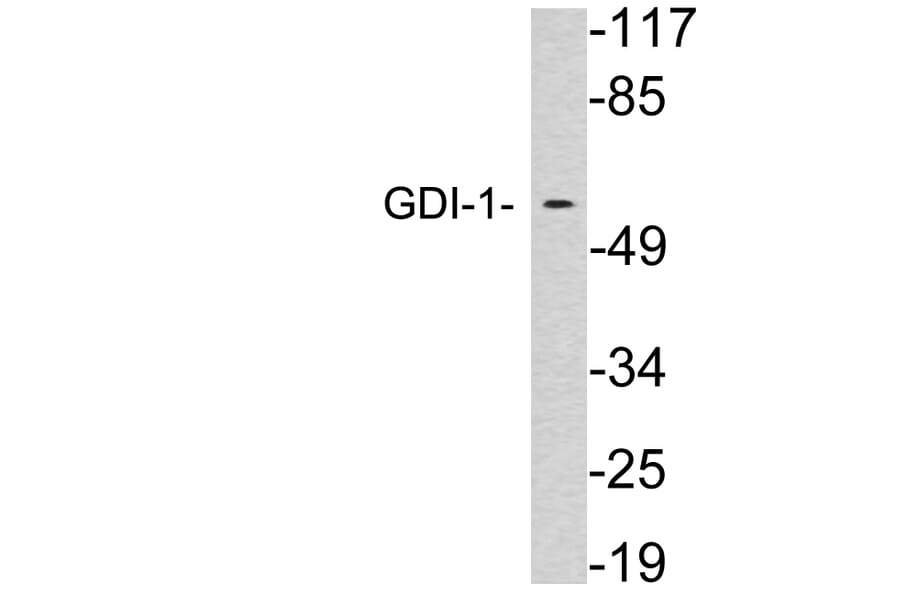 Western Blot - Anti-GDI-1 Antibody (R12-2163) - Antibodies.com