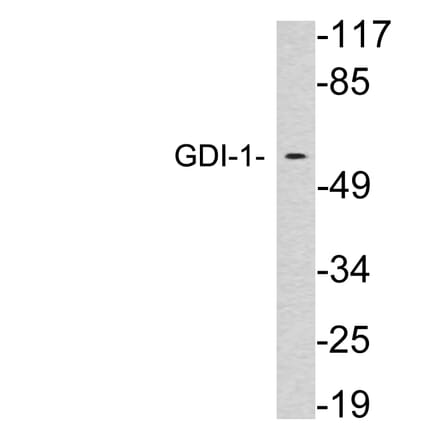 Western Blot - Anti-GDI-1 Antibody (R12-2163) - Antibodies.com
