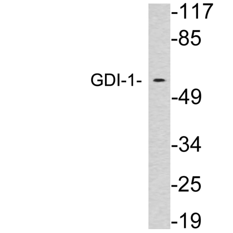 Western Blot - Anti-GDI-1 Antibody (R12-2163) - Antibodies.com