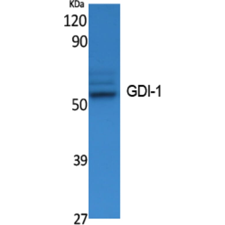 Western Blot - Anti-GDI-1 Antibody (R12-2163) - Antibodies.com
