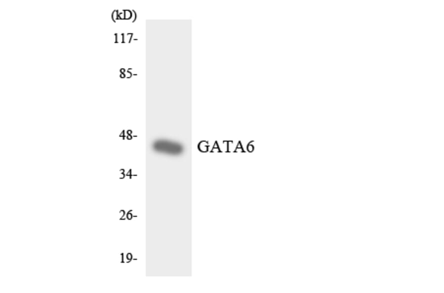 Western Blot - Anti-GATA6 Antibody (R12-2800) - Antibodies.com