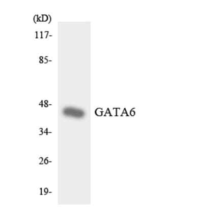 Western Blot - Anti-GATA6 Antibody (R12-2800) - Antibodies.com
