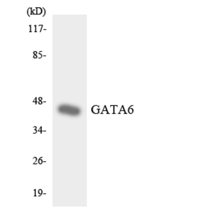 Western Blot - Anti-GATA6 Antibody (R12-2800) - Antibodies.com