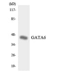 Western Blot - Anti-GATA6 Antibody (R12-2800) - Antibodies.com