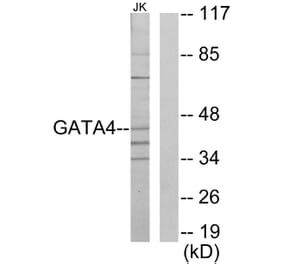 Western Blot - Anti-GATA4 Antibody (C10618) - Antibodies.com
