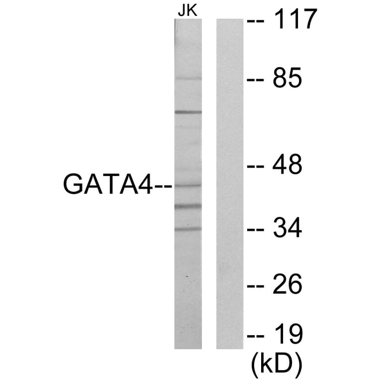 Western Blot - Anti-GATA4 Antibody (C10618) - Antibodies.com