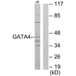 Western Blot - Anti-GATA4 Antibody (C10618) - Antibodies.com