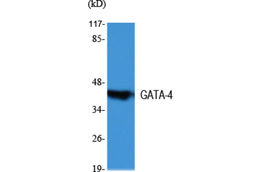 Western Blot - Anti-GATA4 Antibody (C10618) - Antibodies.com