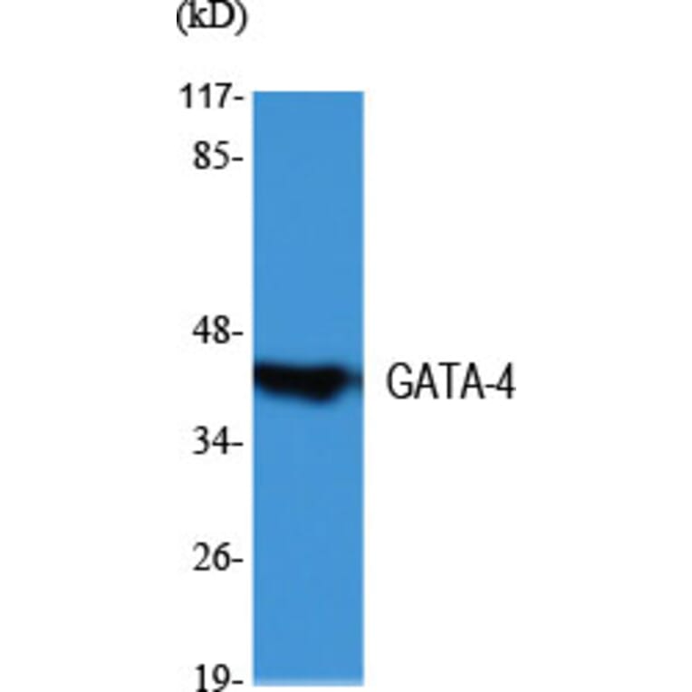 Western Blot - Anti-GATA4 Antibody (C10618) - Antibodies.com