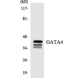 Western Blot - Anti-GATA4 Antibody (R12-2799) - Antibodies.com