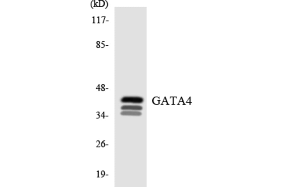Western Blot - Anti-GATA4 Antibody (R12-2799) - Antibodies.com