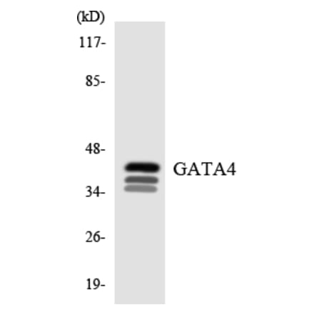 Western Blot - Anti-GATA4 Antibody (R12-2799) - Antibodies.com