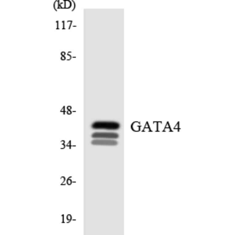 Western Blot - Anti-GATA4 Antibody (R12-2799) - Antibodies.com