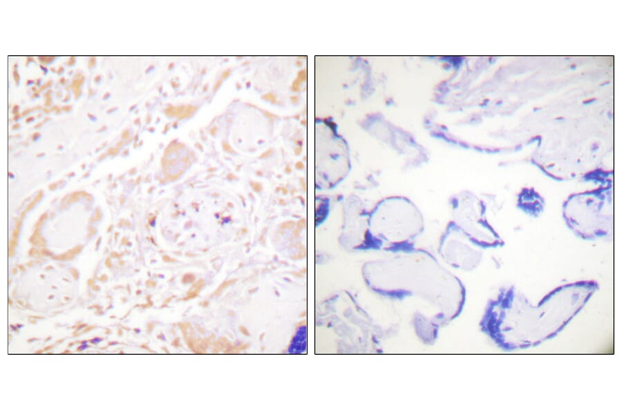 Immunohistochemistry - Anti-GATA3 Antibody (B0933) - Antibodies.com