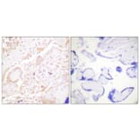 Immunohistochemistry - Anti-GATA3 Antibody (B0933) - Antibodies.com