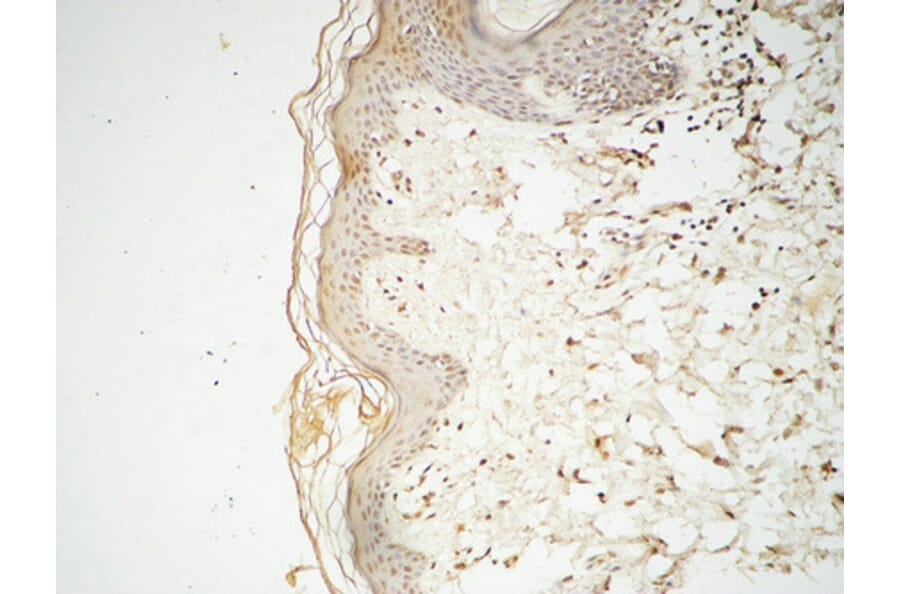 Immunohistochemistry - Anti-GATA3 Antibody (B0933) - Antibodies.com