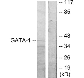 Western Blot - Anti-GATA1 Antibody (B7093) - Antibodies.com