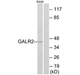 Western Blot - Anti-GALR2 Antibody (G268) - Antibodies.com
