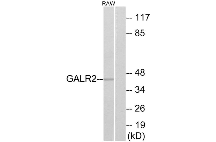 Western Blot - Anti-GALR2 Antibody (G268) - Antibodies.com