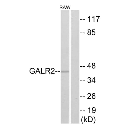 Western Blot - Anti-GALR2 Antibody (G268) - Antibodies.com
