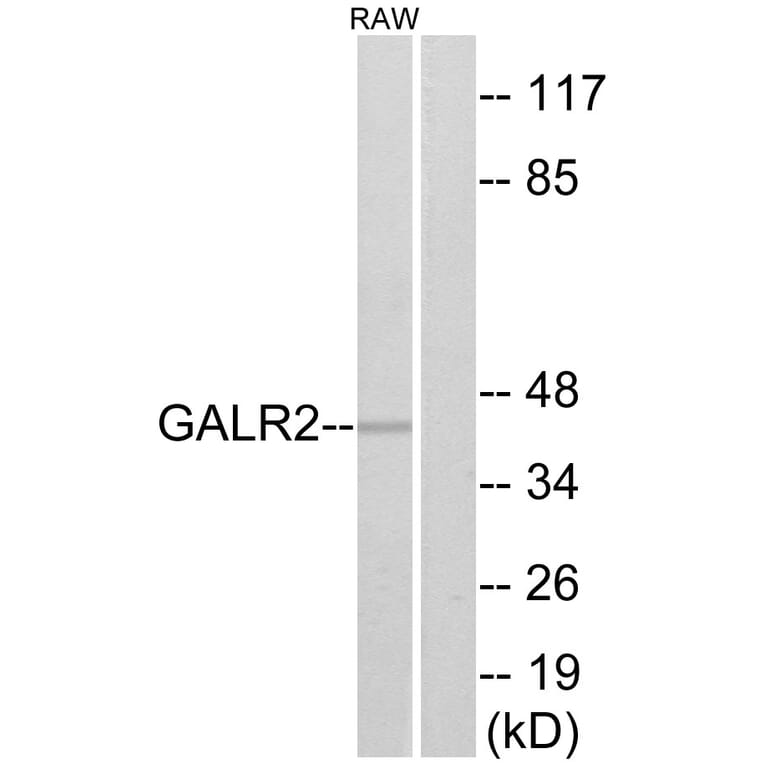 Western Blot - Anti-GALR2 Antibody (G268) - Antibodies.com