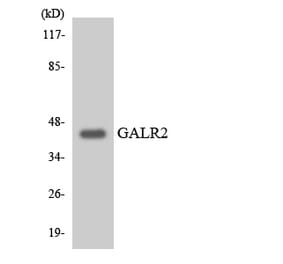 Western Blot - Anti-GALR2 Antibody (R12-2795) - Antibodies.com