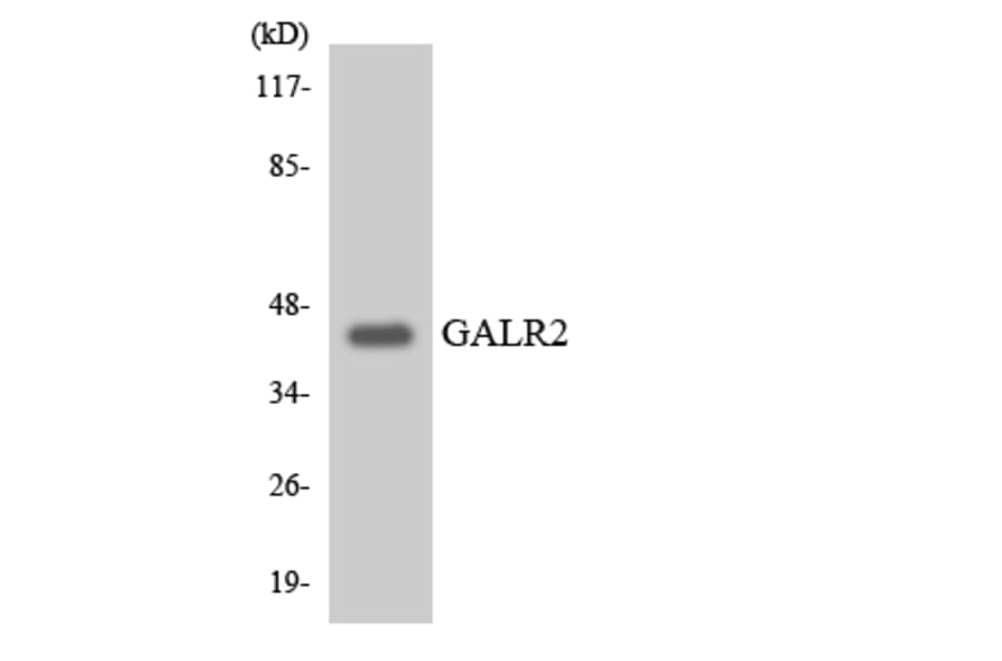 Western Blot - Anti-GALR2 Antibody (R12-2795) - Antibodies.com