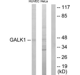 Western Blot - Anti-GALK1 Antibody (C10680) - Antibodies.com