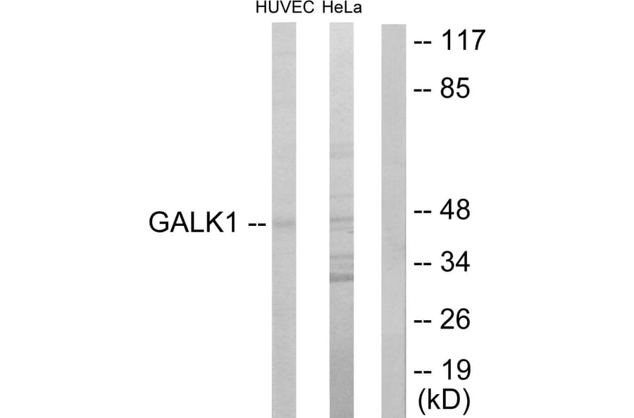 Western Blot - Anti-GALK1 Antibody (C10680) - Antibodies.com