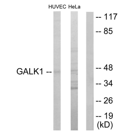 Western Blot - Anti-GALK1 Antibody (C10680) - Antibodies.com