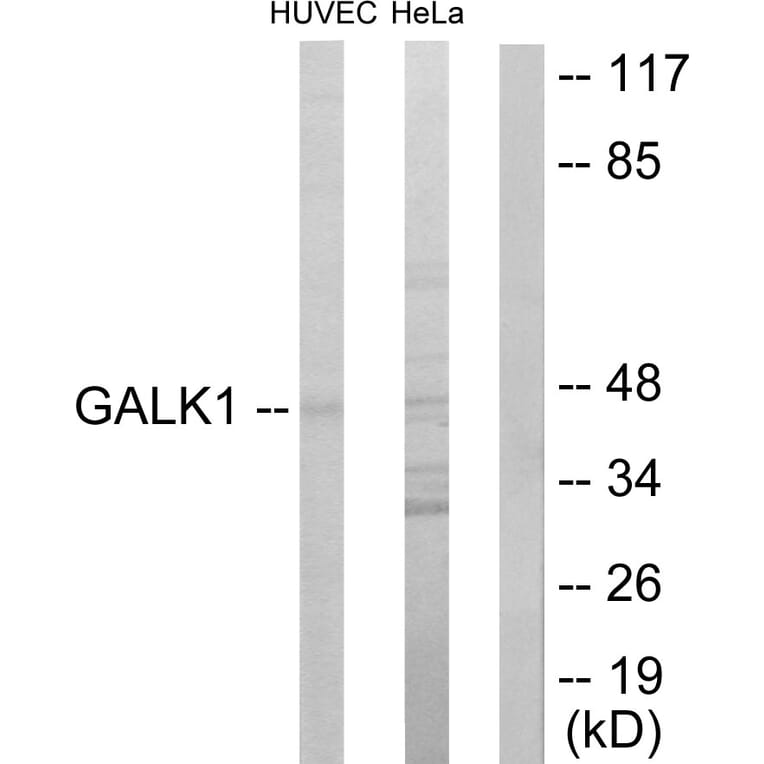 Western Blot - Anti-GALK1 Antibody (C10680) - Antibodies.com