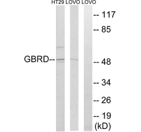 Western Blot - Anti-GABRD Antibody (C15856) - Antibodies.com
