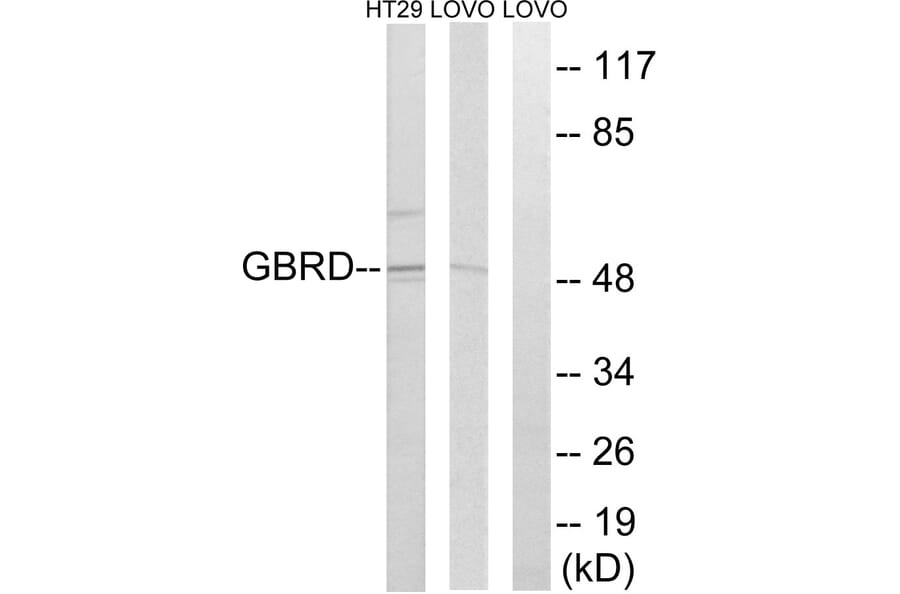 Western Blot - Anti-GABRD Antibody (C15856) - Antibodies.com