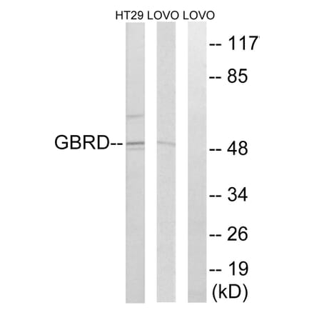 Western Blot - Anti-GABRD Antibody (C15856) - Antibodies.com