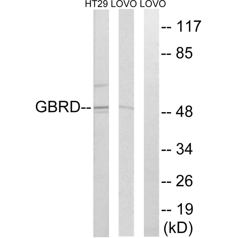 Western Blot - Anti-GABRD Antibody (C15856) - Antibodies.com