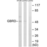 Western Blot - Anti-GABRD Antibody (C15856) - Antibodies.com