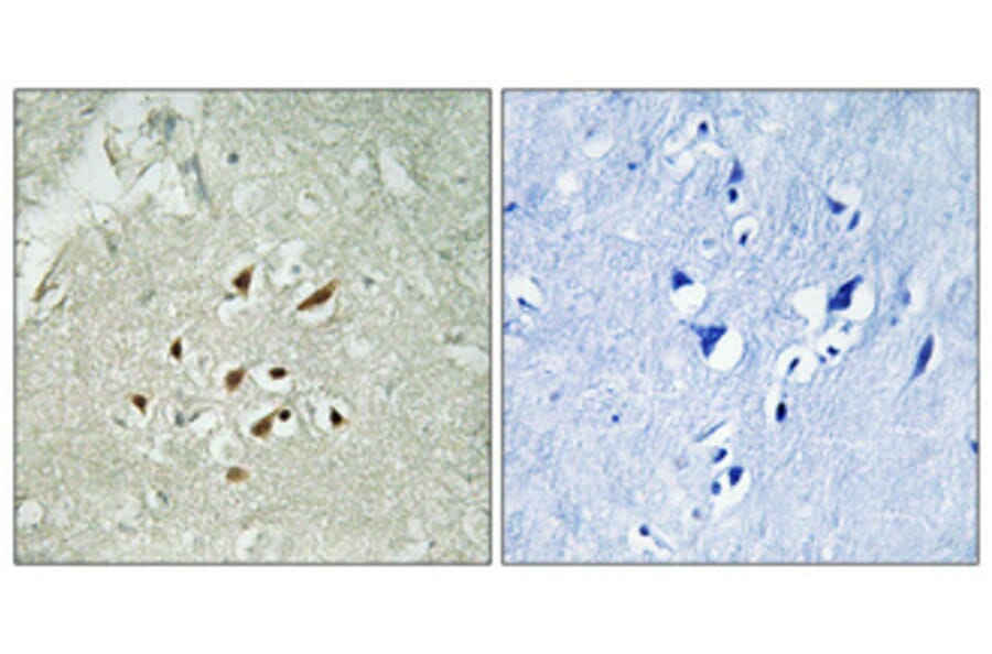 Immunohistochemistry - Anti-FUBP3 Antibody (C15743) - Antibodies.com