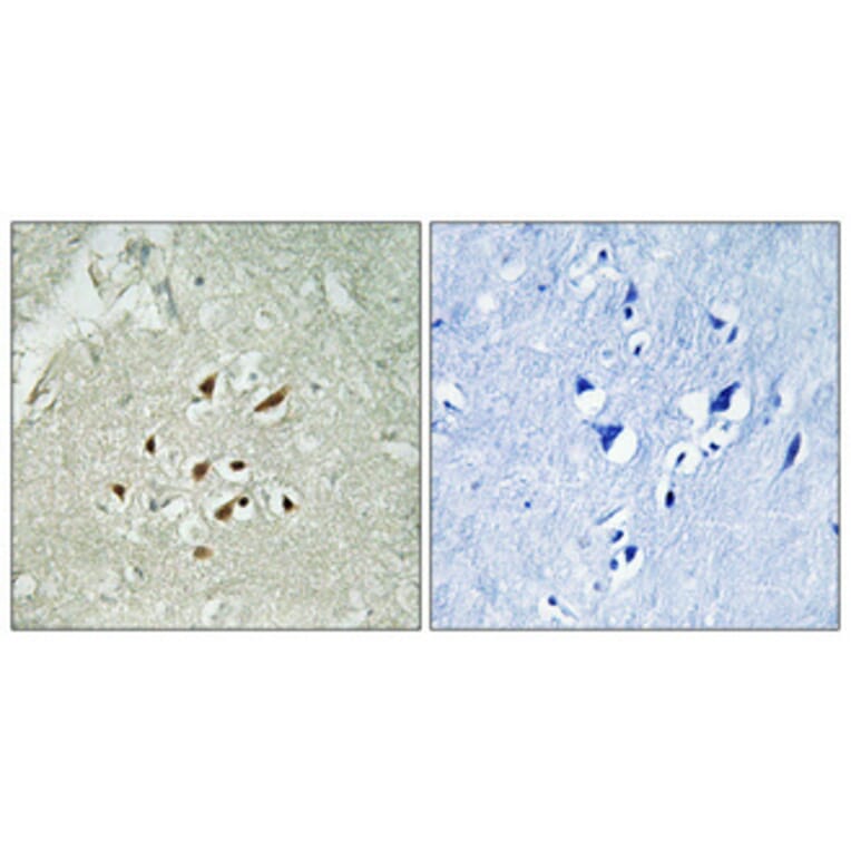 Immunohistochemistry - Anti-FUBP3 Antibody (C15743) - Antibodies.com