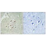 Immunohistochemistry - Anti-FUBP3 Antibody (C15743) - Antibodies.com