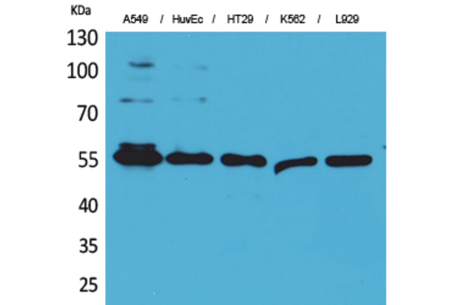 Western Blot - Anti-FSCN1 Antibody (C30221) - Antibodies.com
