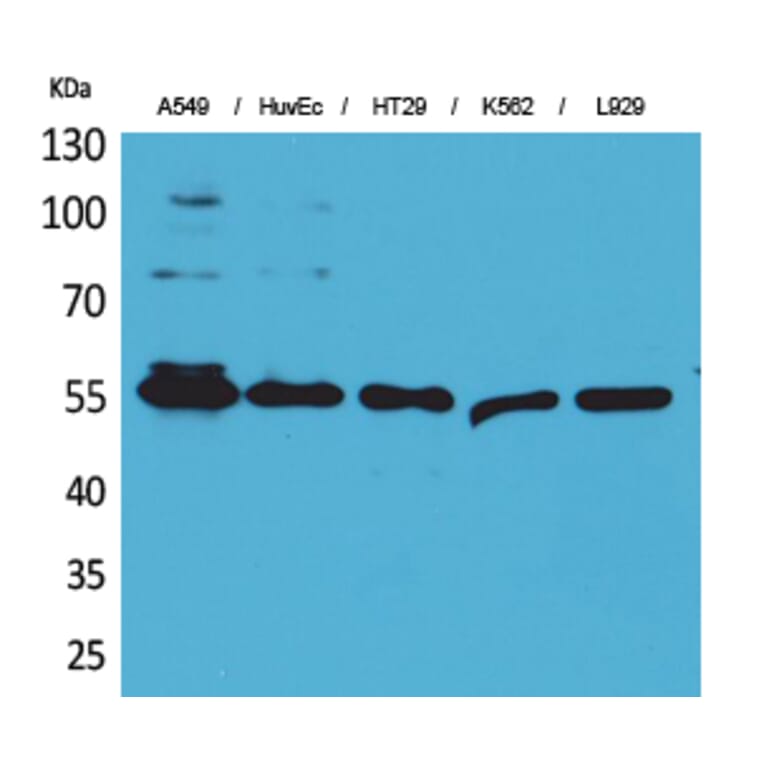 Western Blot - Anti-FSCN1 Antibody (C30221) - Antibodies.com