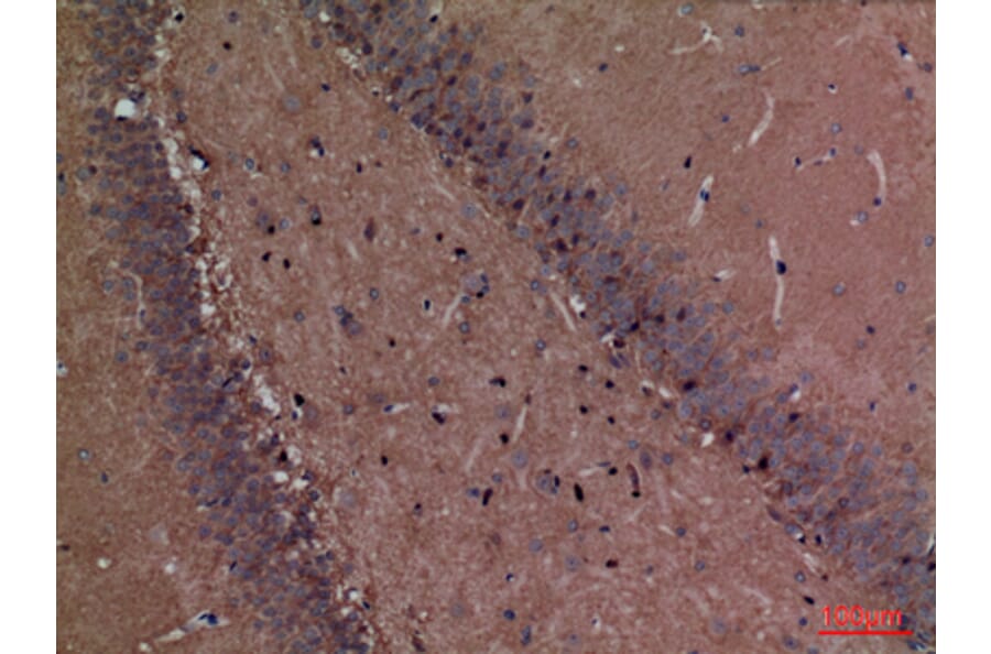 Immunohistochemistry - Anti-FSCN1 Antibody (C30221) - Antibodies.com