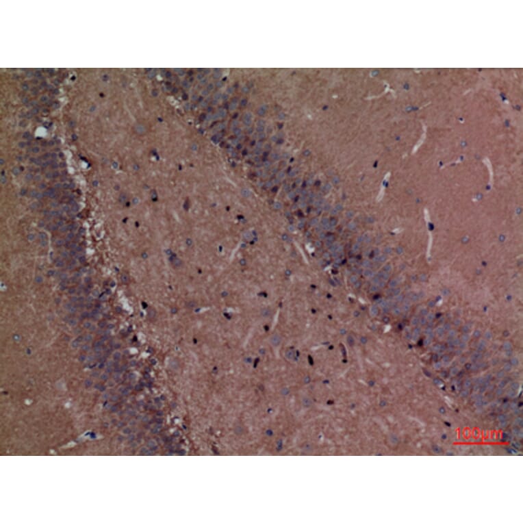 Immunohistochemistry - Anti-FSCN1 Antibody (C30221) - Antibodies.com