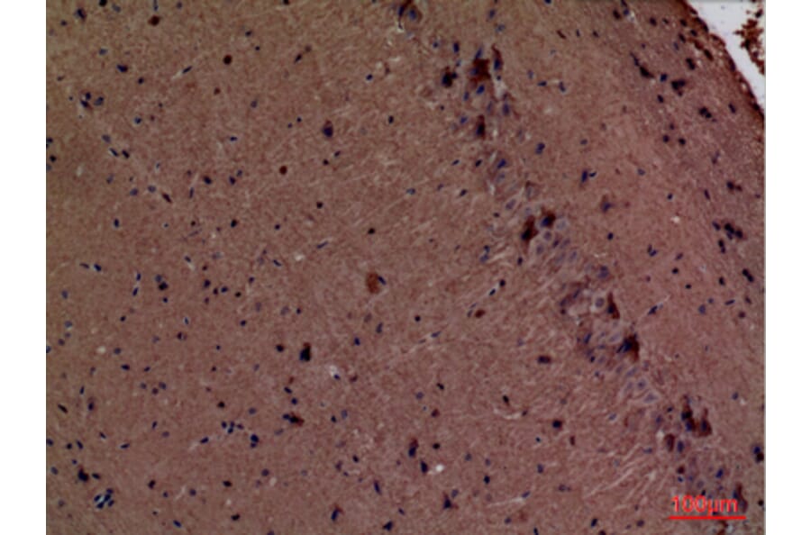 Immunohistochemistry - Anti-FSCN1 Antibody (C30221) - Antibodies.com