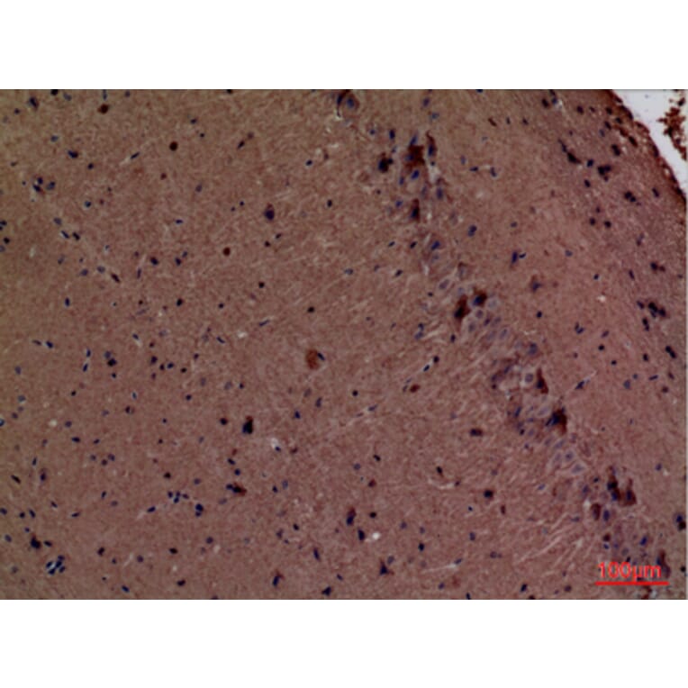 Immunohistochemistry - Anti-FSCN1 Antibody (C30221) - Antibodies.com