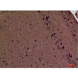 Immunohistochemistry - Anti-FSCN1 Antibody (C30221) - Antibodies.com