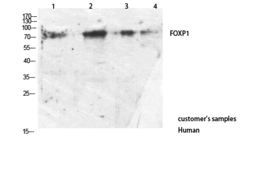 Western Blot - Anti-FOXP1 Antibody (C30231) - Antibodies.com