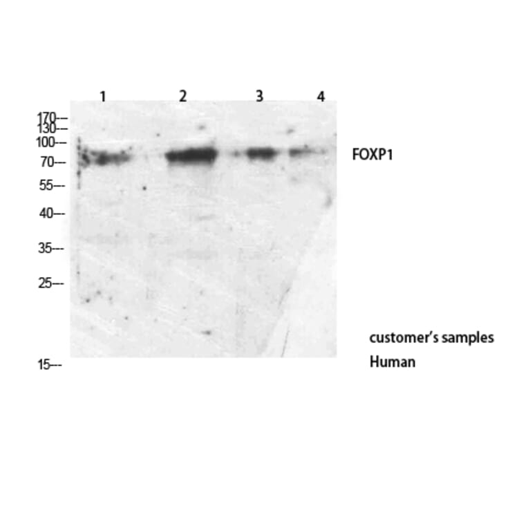 Western Blot - Anti-FOXP1 Antibody (C30231) - Antibodies.com