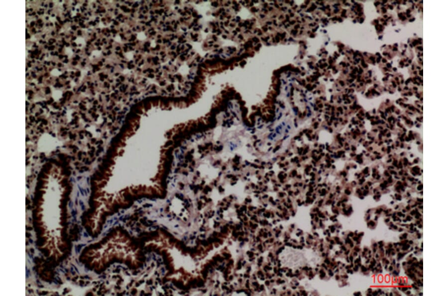 Immunohistochemistry - Anti-FOXP1 Antibody (C30231) - Antibodies.com