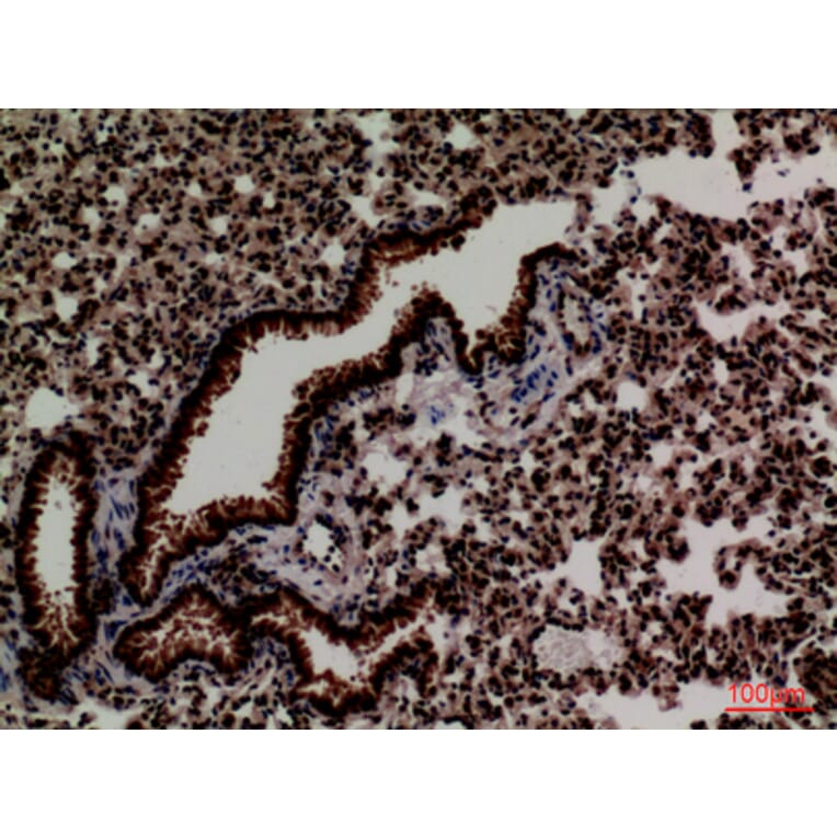 Immunohistochemistry - Anti-FOXP1 Antibody (C30231) - Antibodies.com